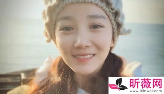 陈小纭早期照片：陈小纭八卦整容了吗