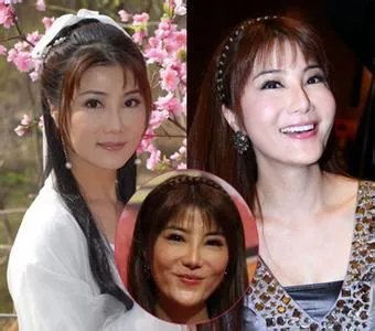 杨丽菁整容之后变成什么样子？