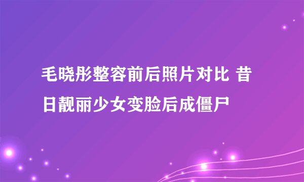毛晓彤整容前后照片对比 昔日靓丽少女变脸后成僵尸