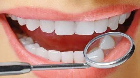 皓齿美白牙齿多少钱