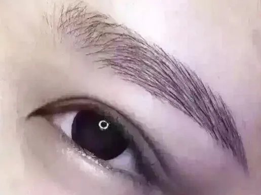 切双眼皮大概要多少钱