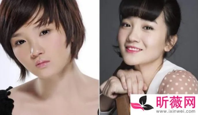 陈小纭早期照片：陈小纭八卦整容了吗