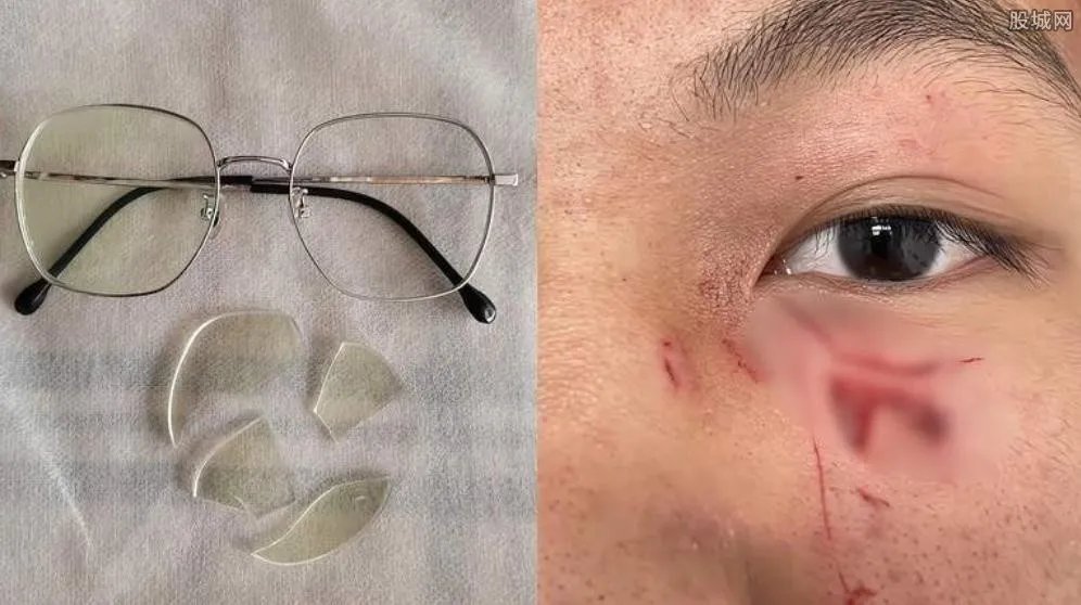 陕西15岁男生遭老师殴打缝16针 被打原因是什么？