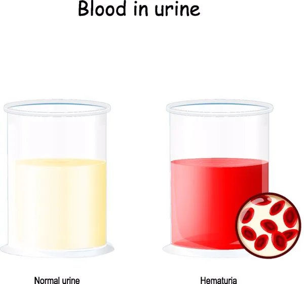 为什么要储存自己的免疫细胞