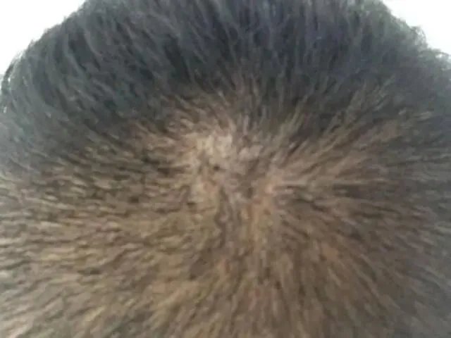 泰安比较好的私立试管婴儿医院？泰安附属医院试管评价？