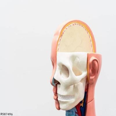 脑肿瘤的症状前兆有哪些 脑肿瘤有三个共通点