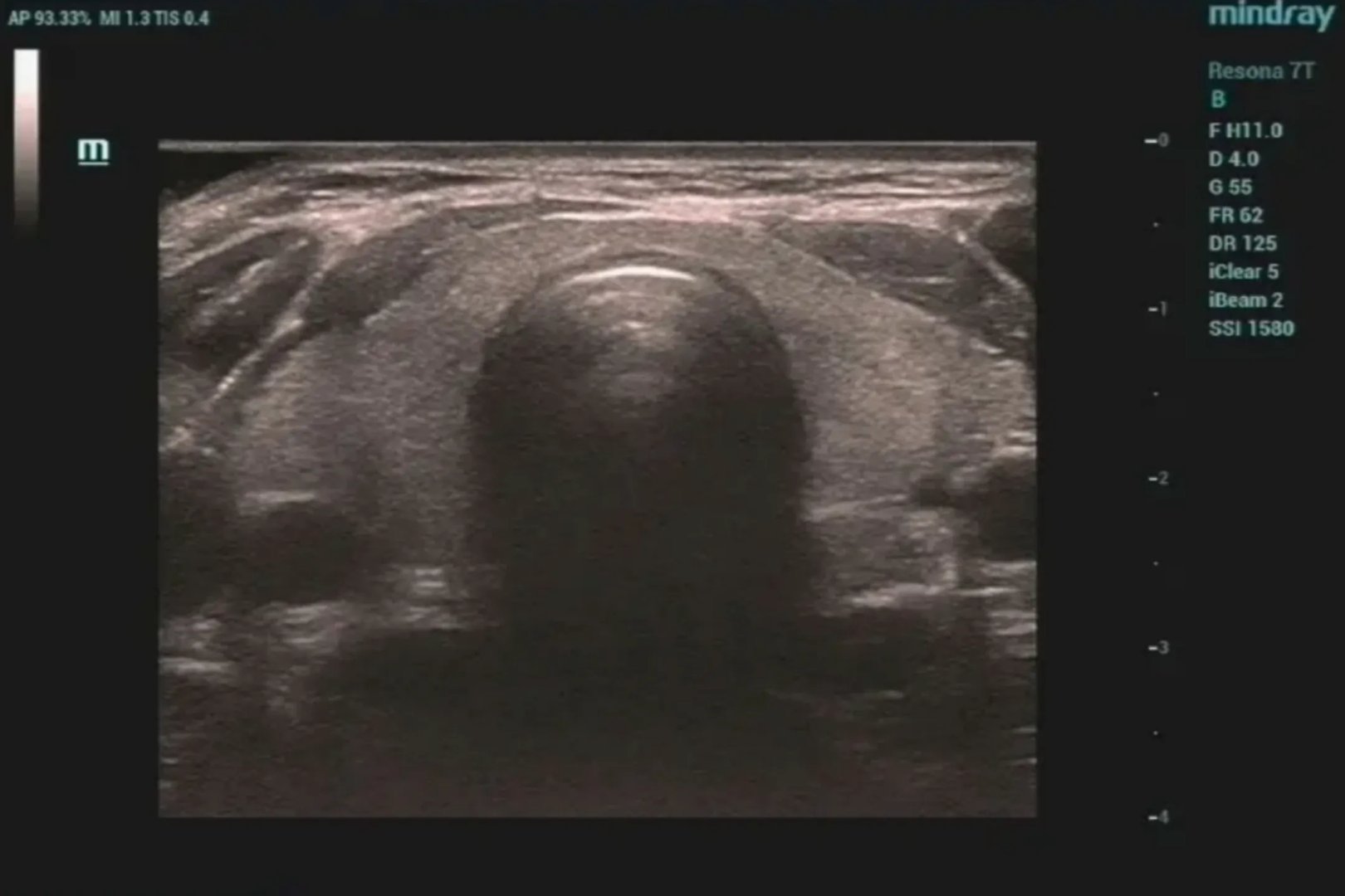 彩超是检查哪些部位的