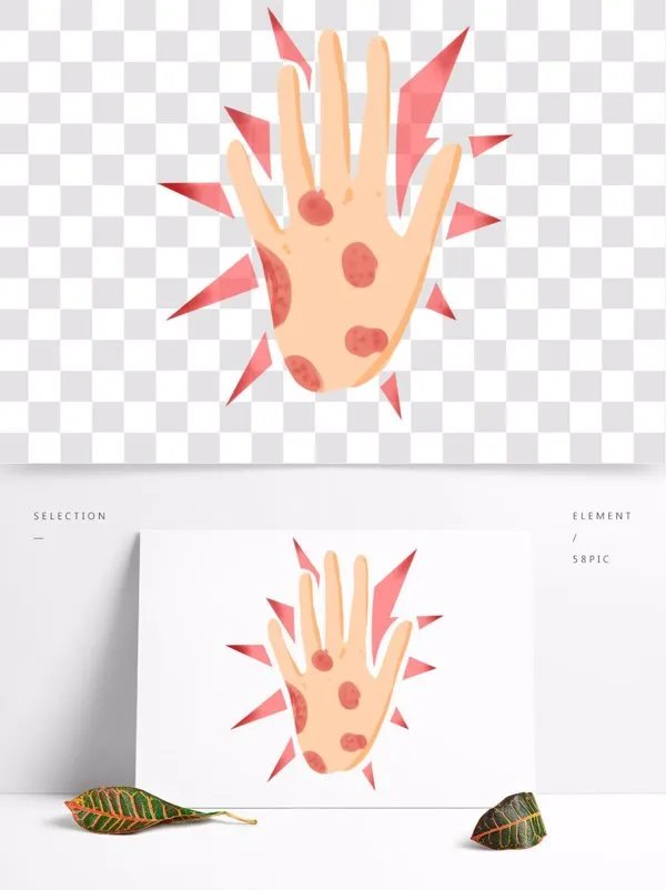 克尔病是种什么病