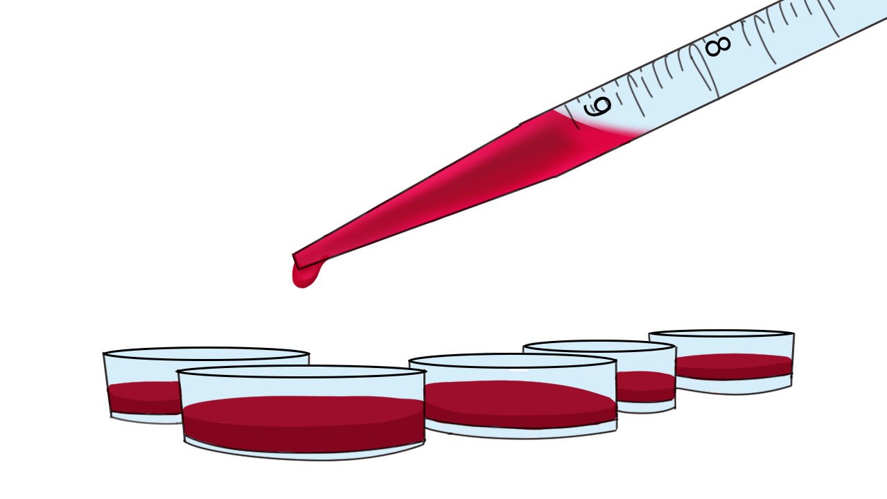 红细胞平均体积