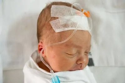 黄疸怎样治 四个方法消除黄疸