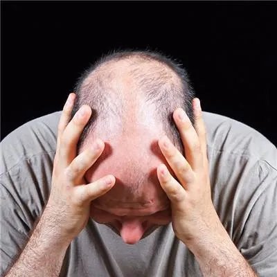 头上长脓包怎么办