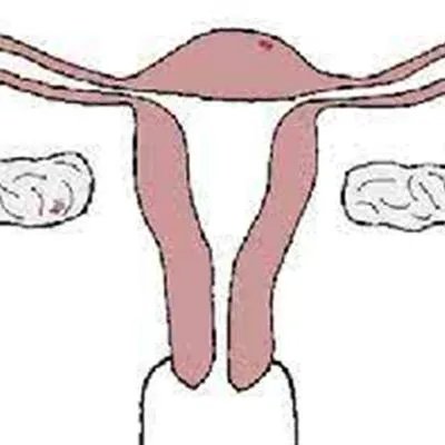 女人为什么要取环