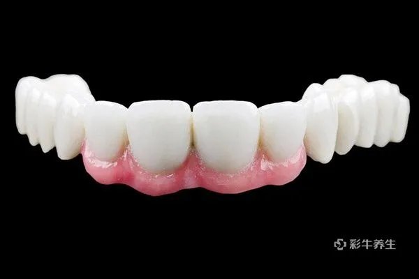 洗牙一次大概多少钱