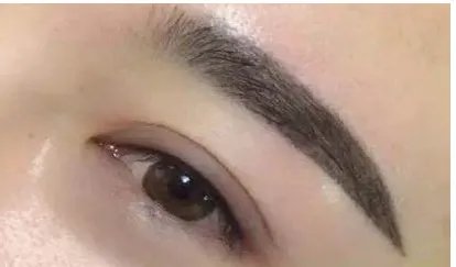 激光洗眉注意事项