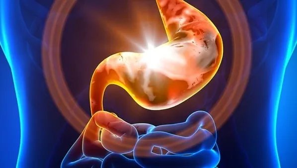 胃溃疡吃什么好